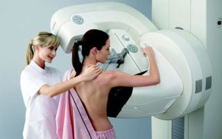 Маммография молочных желез или УЗИ: современные диагностические методики